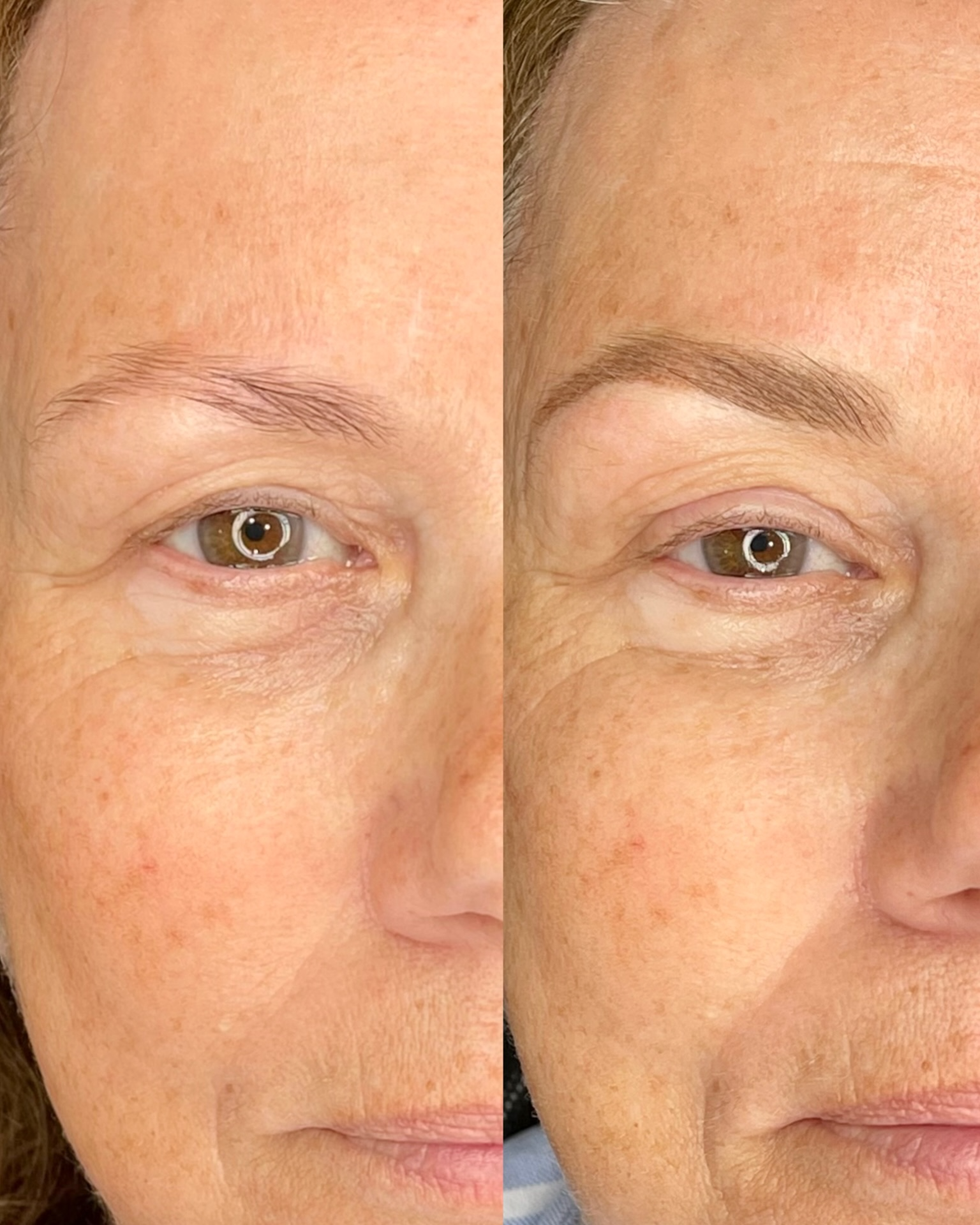 Before and after brow transformation 23