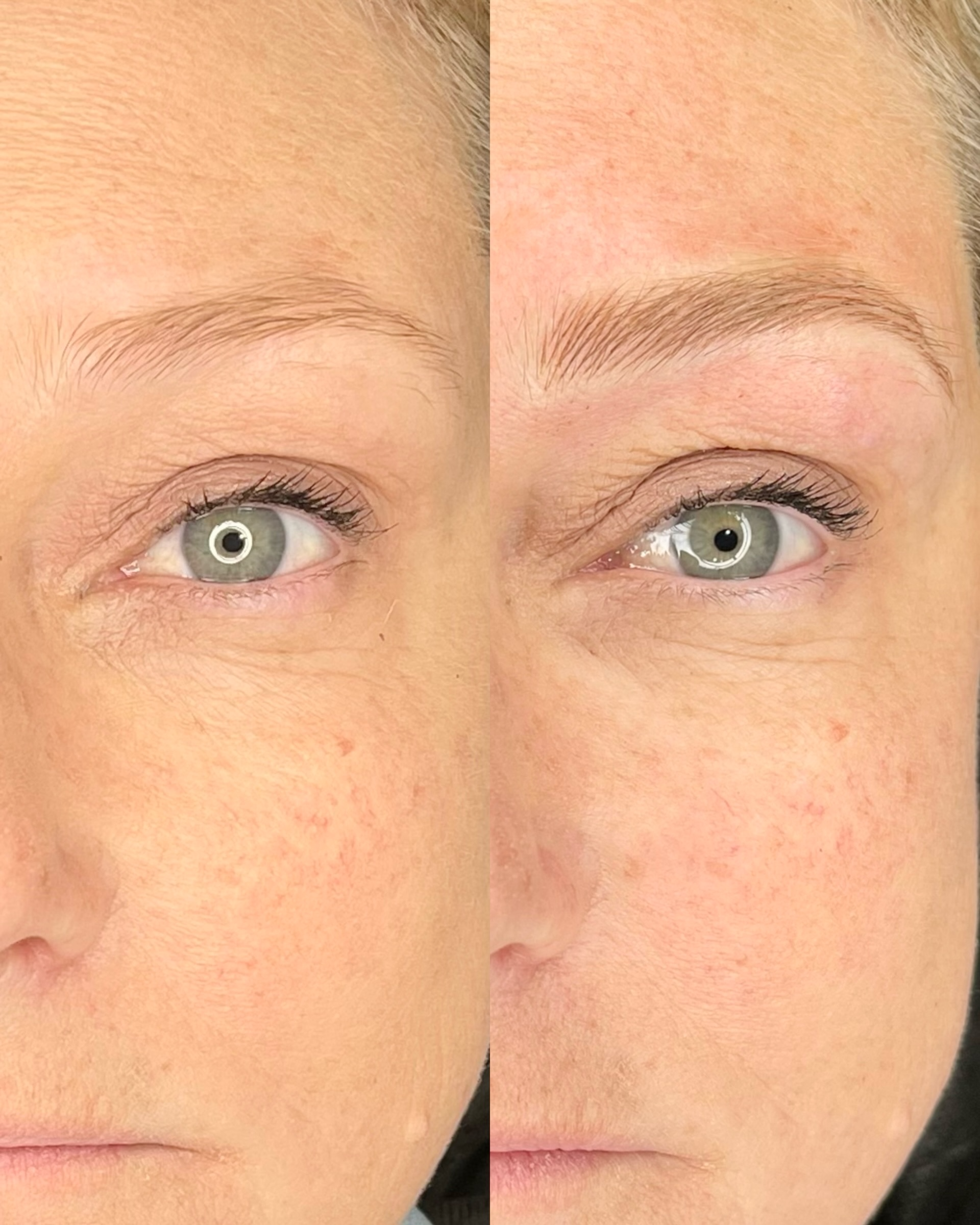 Before and after brow transformation 6