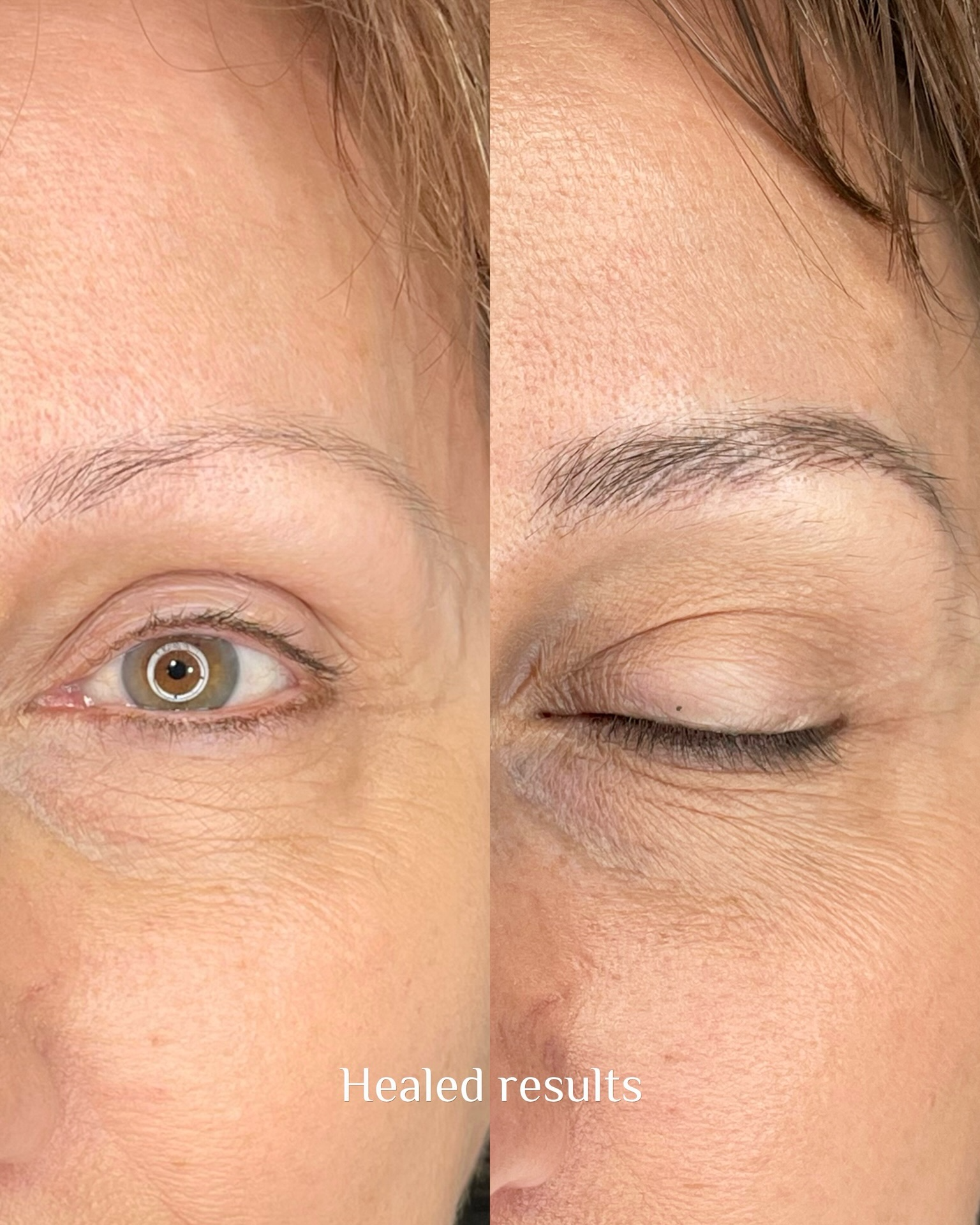 Before and after brow transformation 10