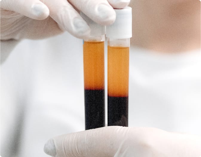 PRF blood tubes