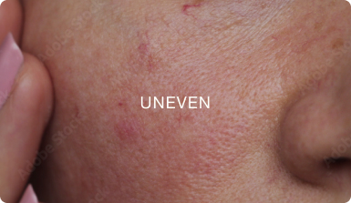 UNEVEN