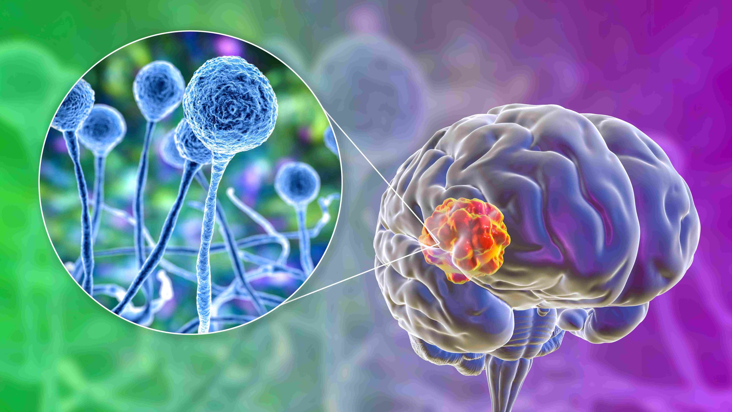 10 Warning Signs of Mold Toxicity: Is Your Home Making You Sick?