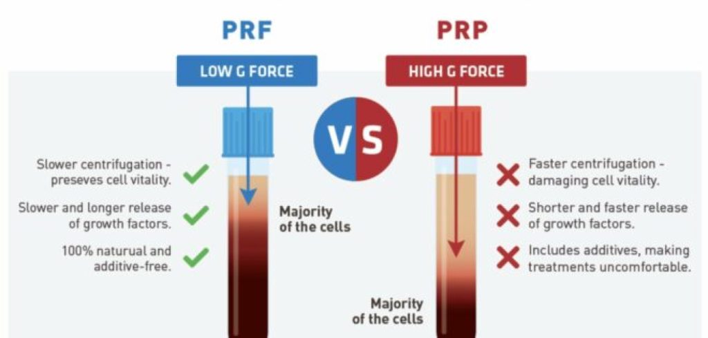PRF vs PRP comparison