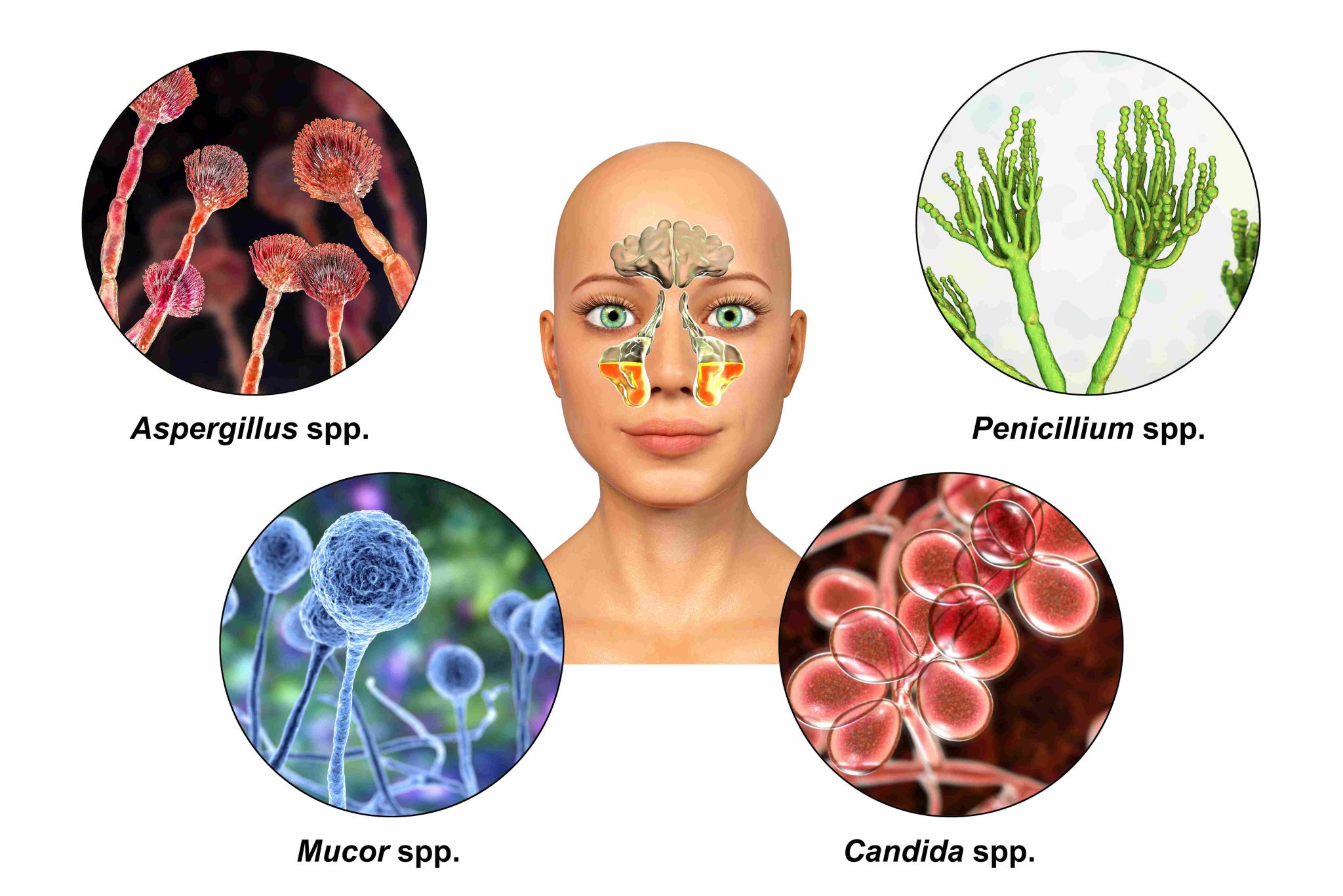 Common mold species: Aspergillus, Penicillium, Mucor, Candida