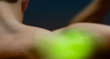 High intensity laser therapy green light shining on a shoulder