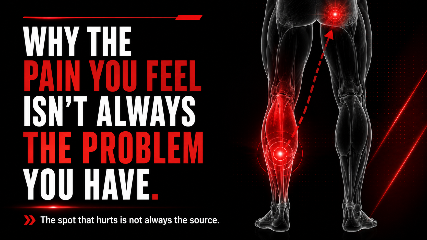 Pain referral diagram showing why calf pain may come from an upstream issue in men over 40