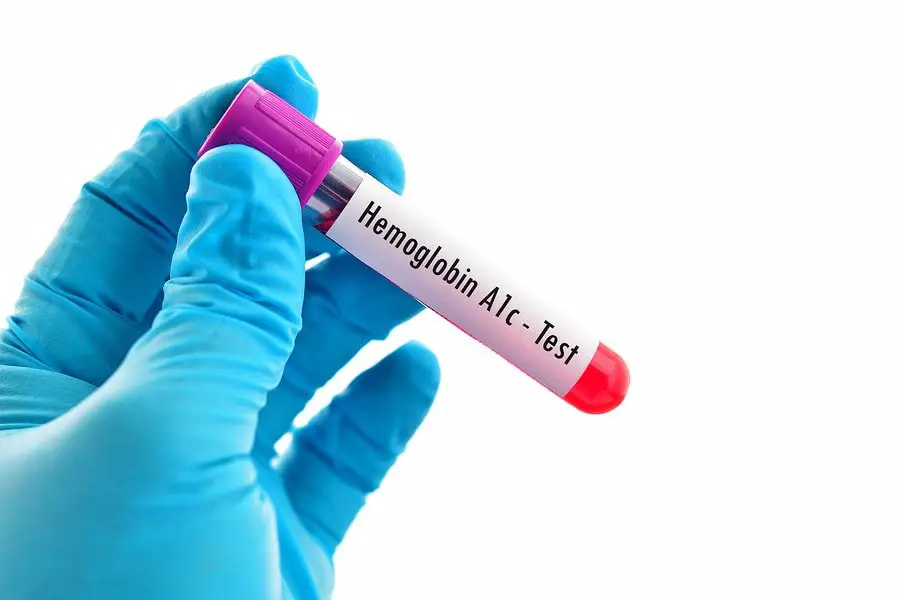 Hemoglobin A1c (HbA1c)