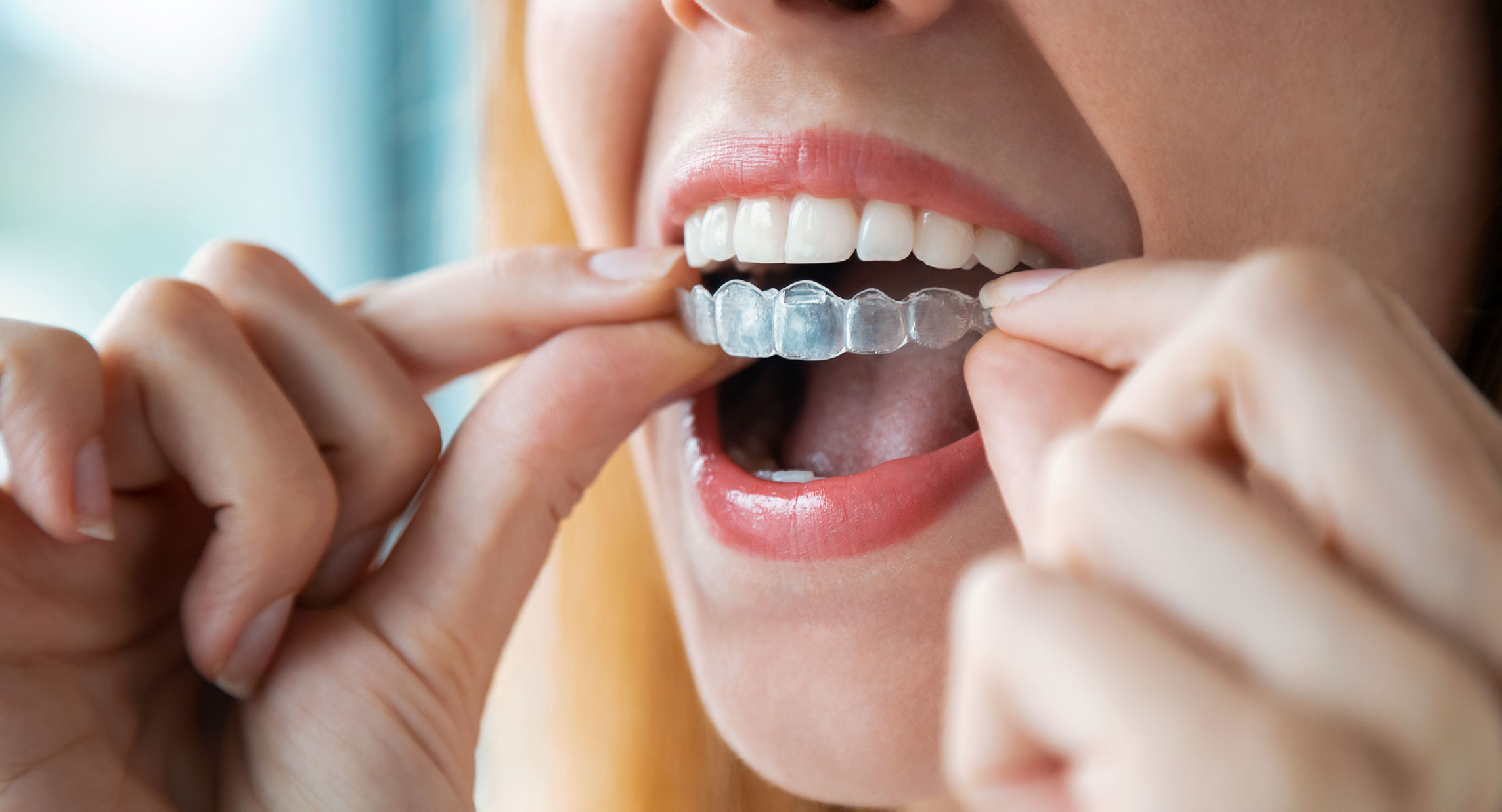 Woman holding invisalign
