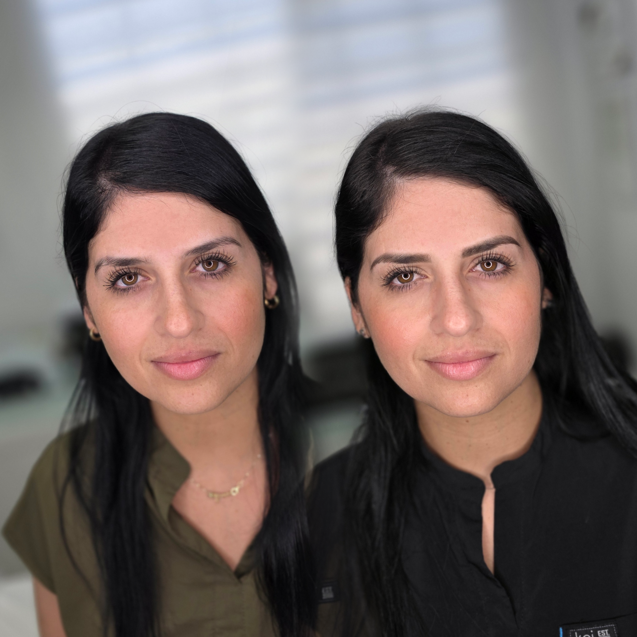 Resultado real de micropigmentación de cejas — antes y después (6)