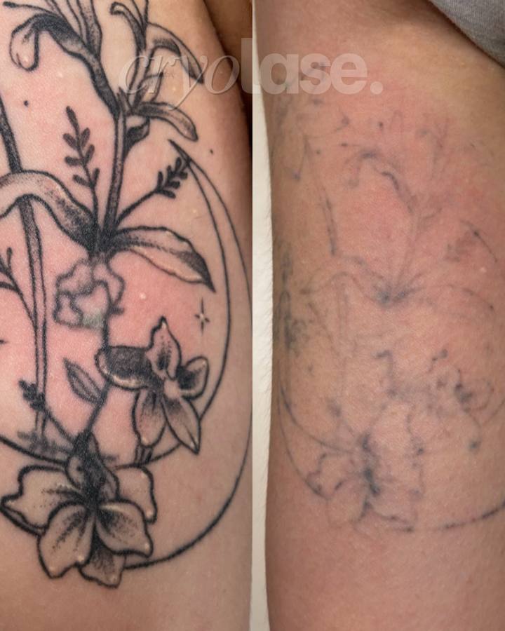 Floral tattoo before and after