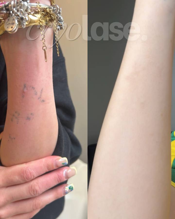 Script tattoo before and after