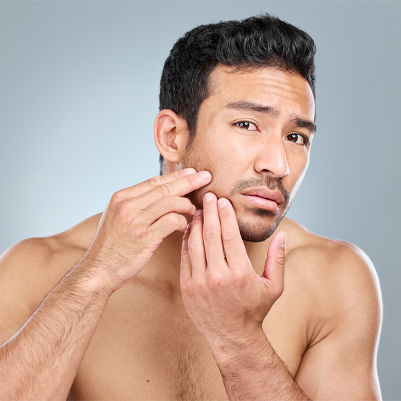 Hyperpigmentation treatment at White Pearl Medical Spa