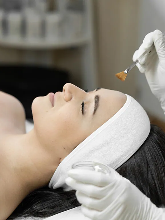 Chemical peel at White Pearl Medical Spa