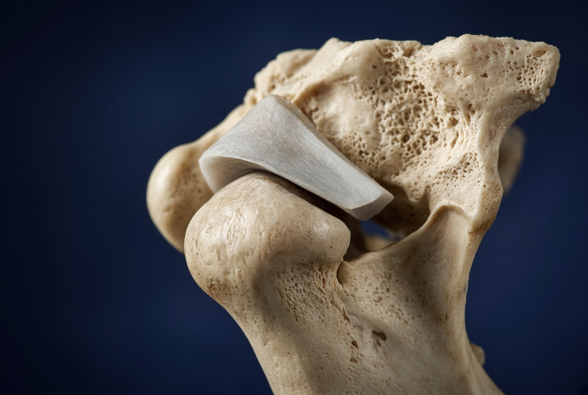 Temporomandibular joint anatomy