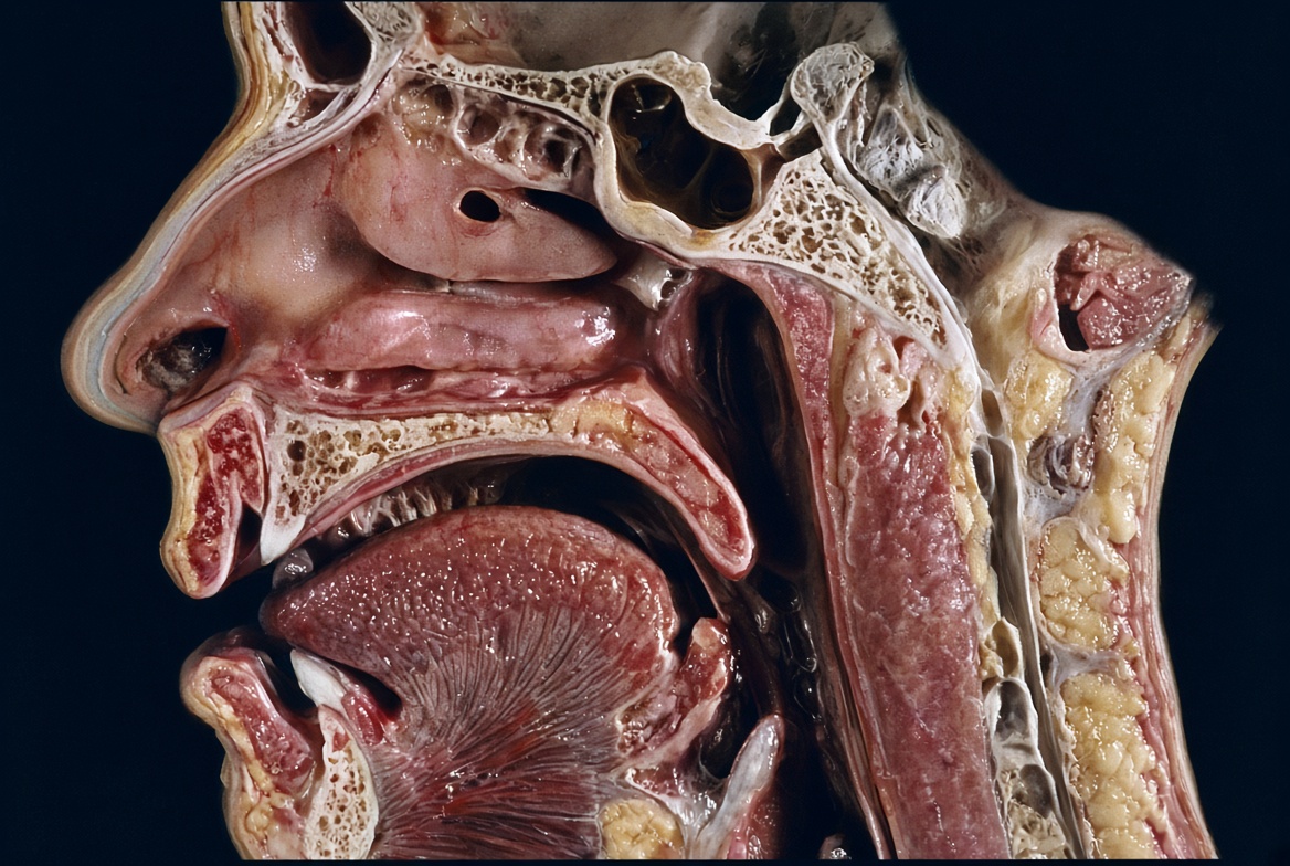 Sagittal upper airway anatomy