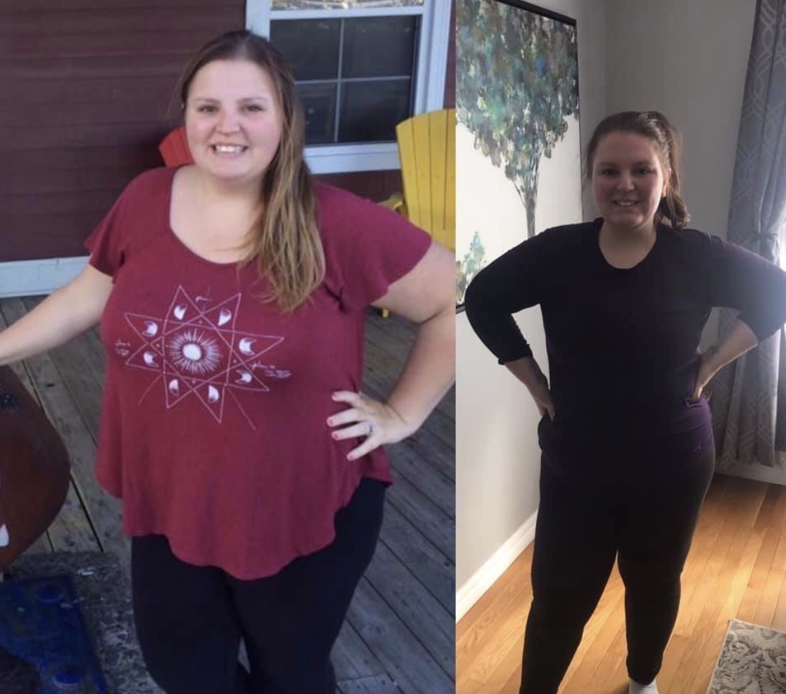 Before and After