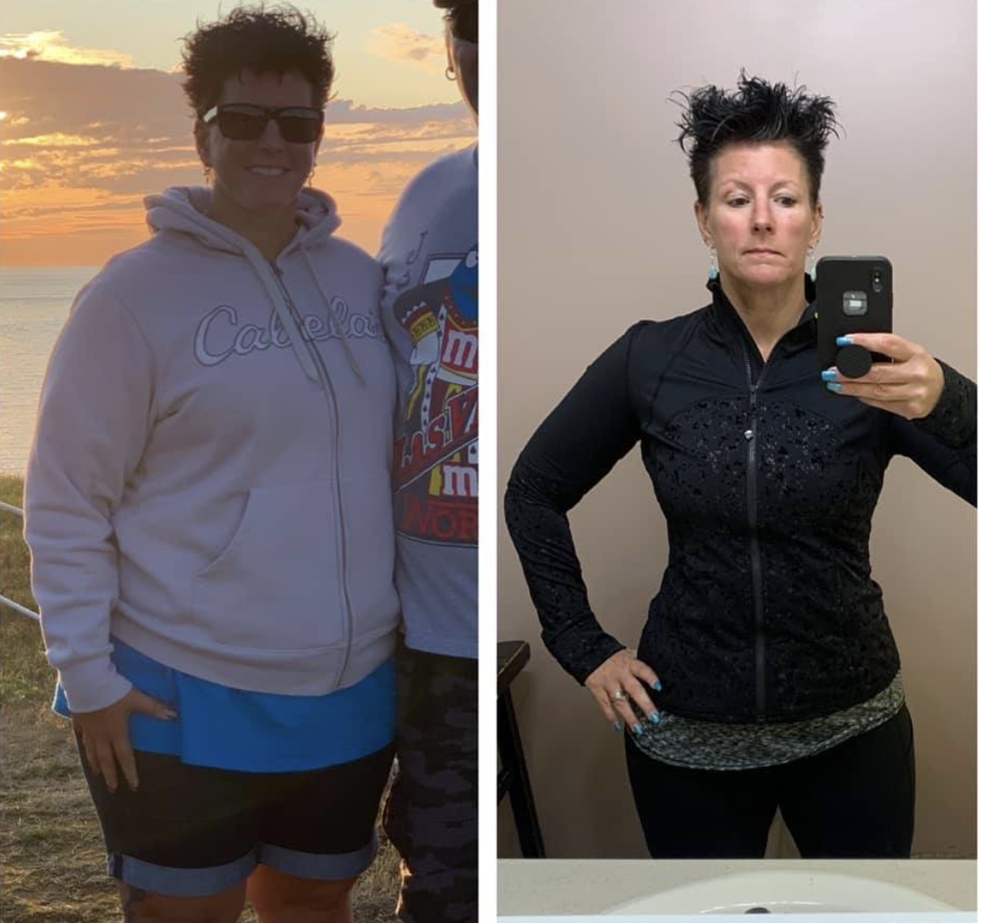 Before and After