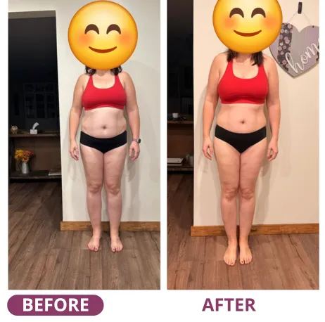 Before and after, front view