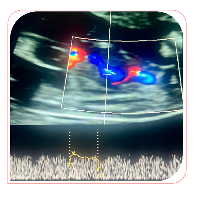 Ultrasonido
Doppler
