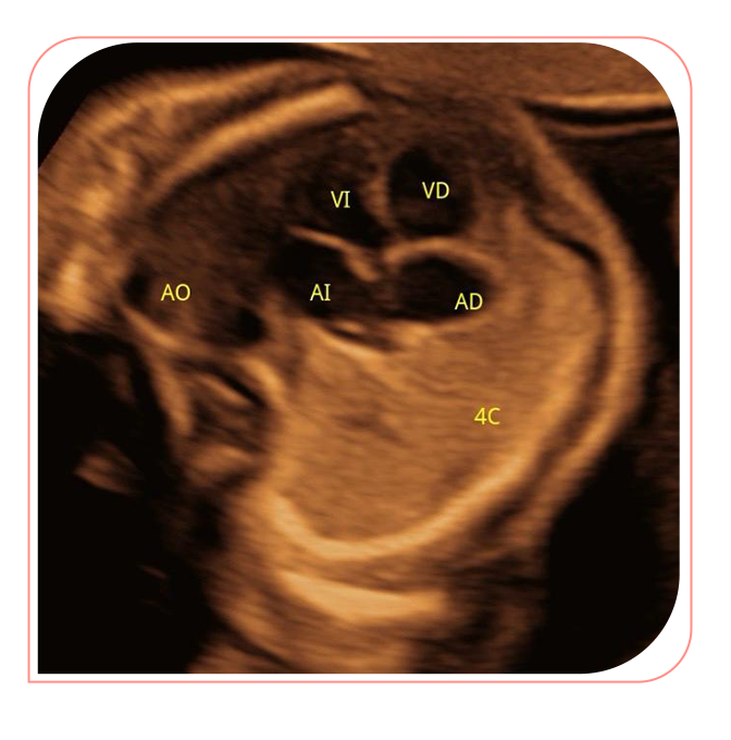 Ecocardiografía fetal avanzada