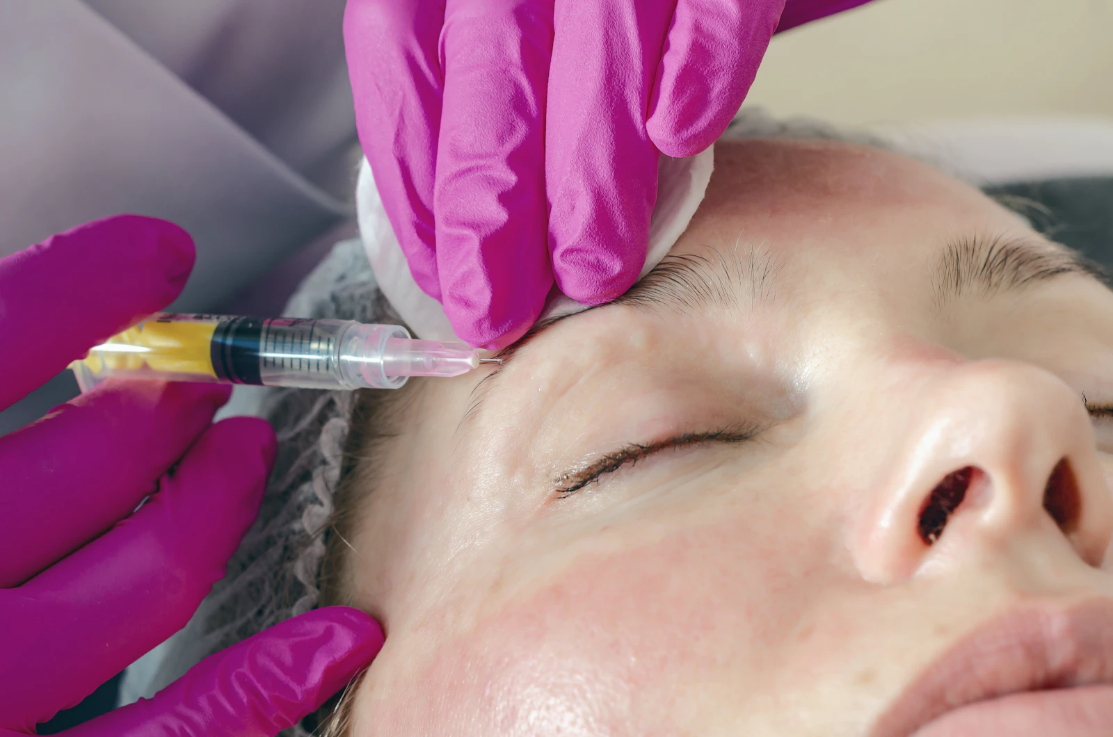 Provider injecting a wrinkle relaxer into the forehead