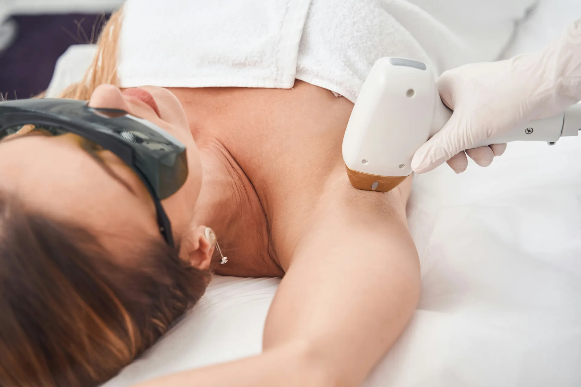 Laser hair removal on the shoulder and underarm area