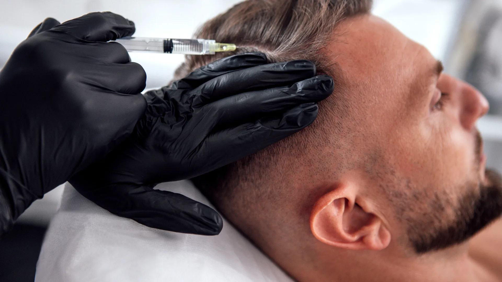 Scalp treatment for PRP hair restoration