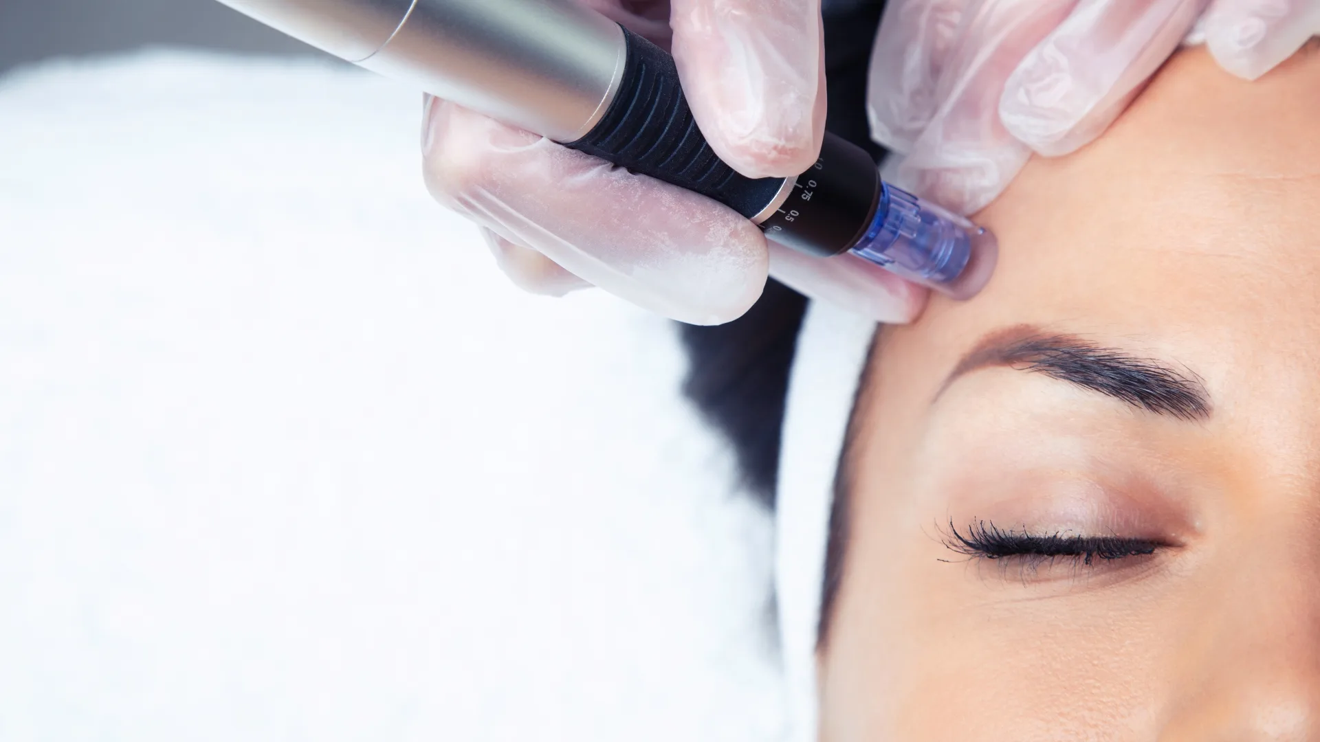 Microneedling pen treatment on the skin