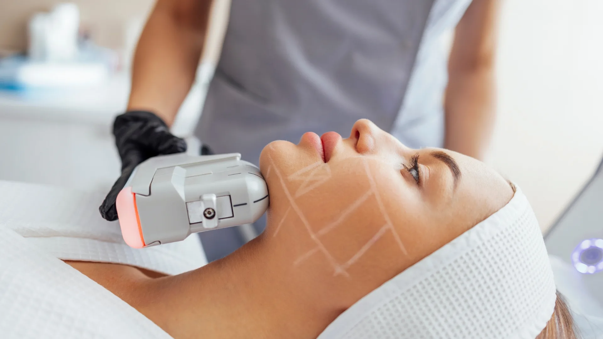 Laser skin resurfacing handpiece on the jawline