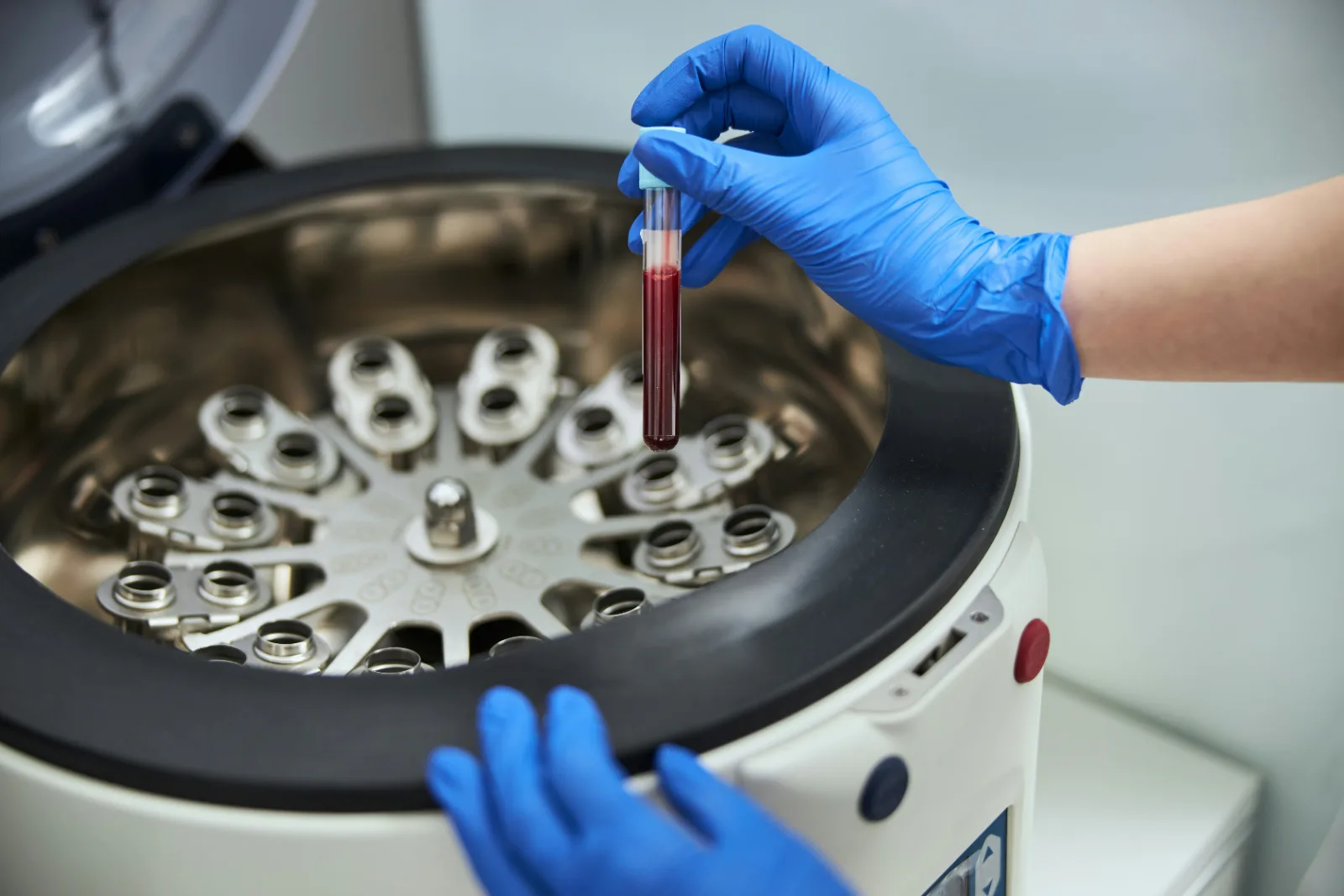 Blood sample going into a lab centrifuge for testing