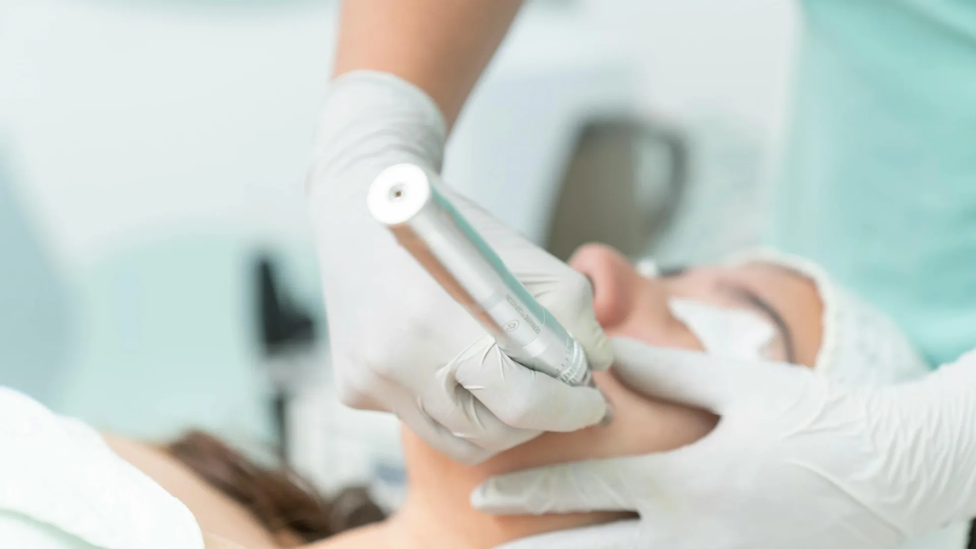 Microneedling pen treatment on the face
