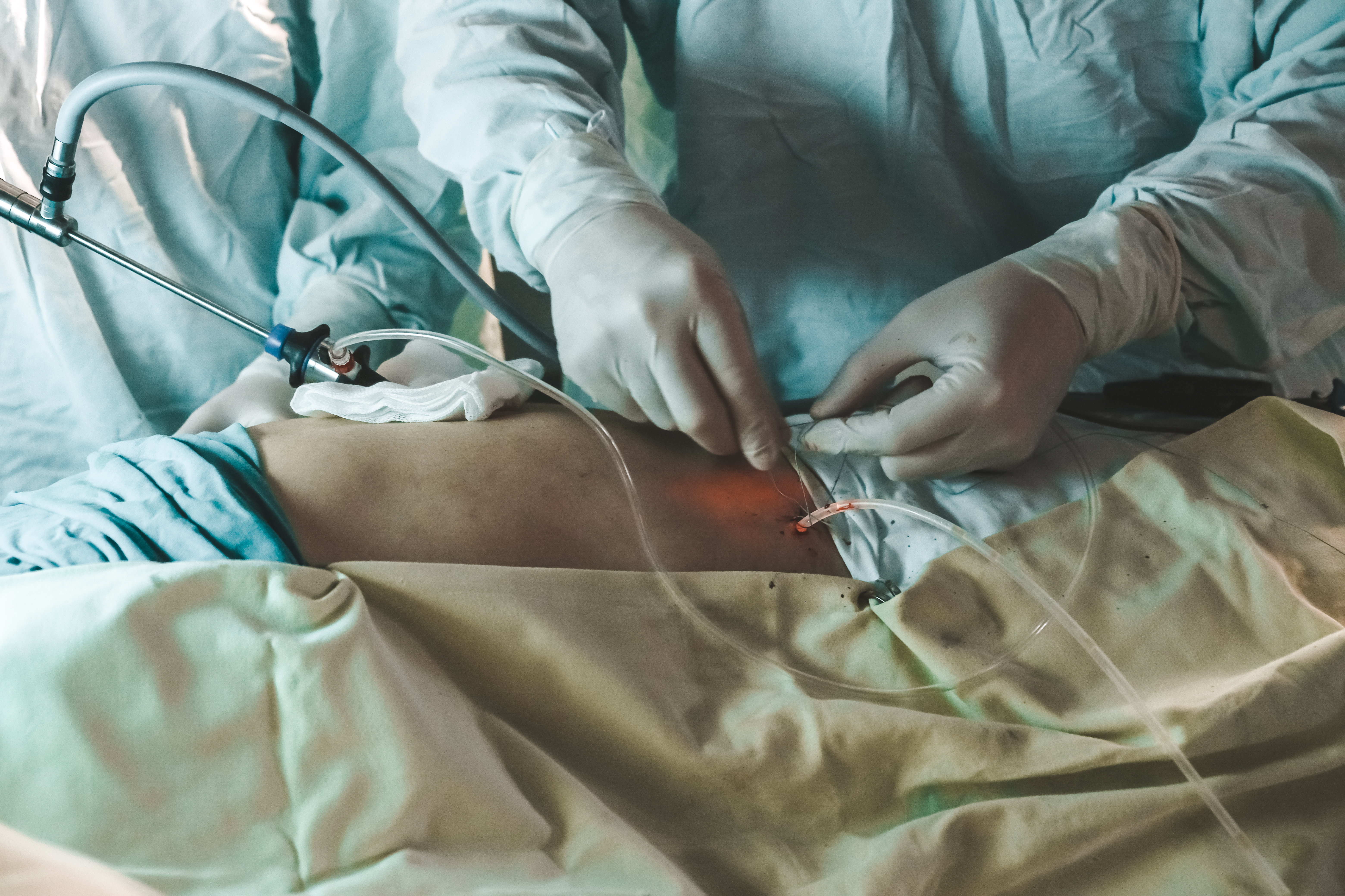 Cirugía bariátrica 9