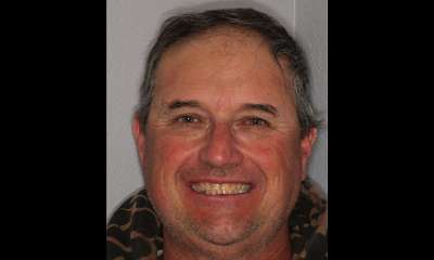 Before Moore Smiles smile makeover