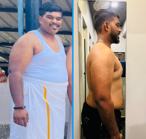 Anoop transformation