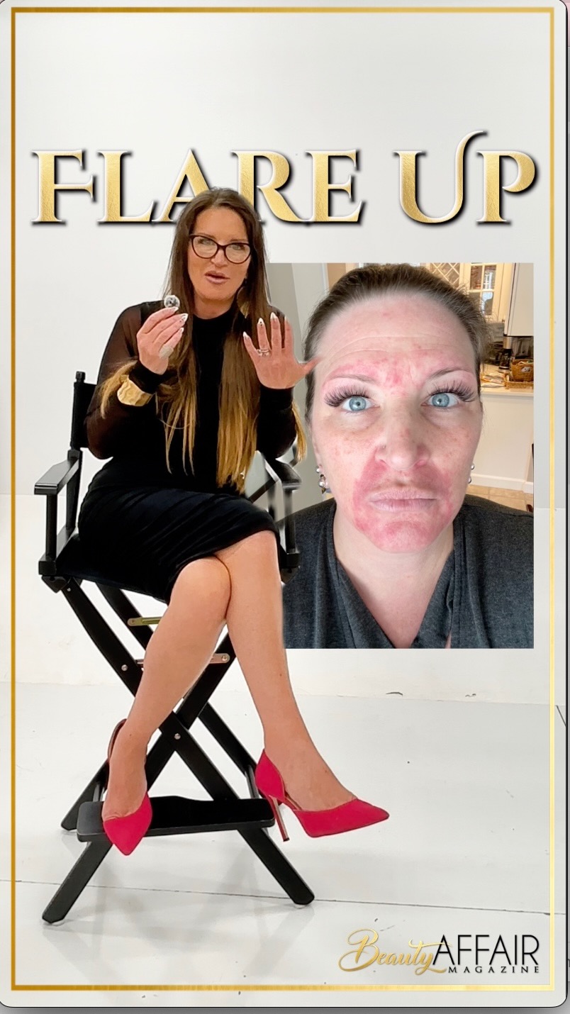 The Beauty Affair founder story video — Flare Up