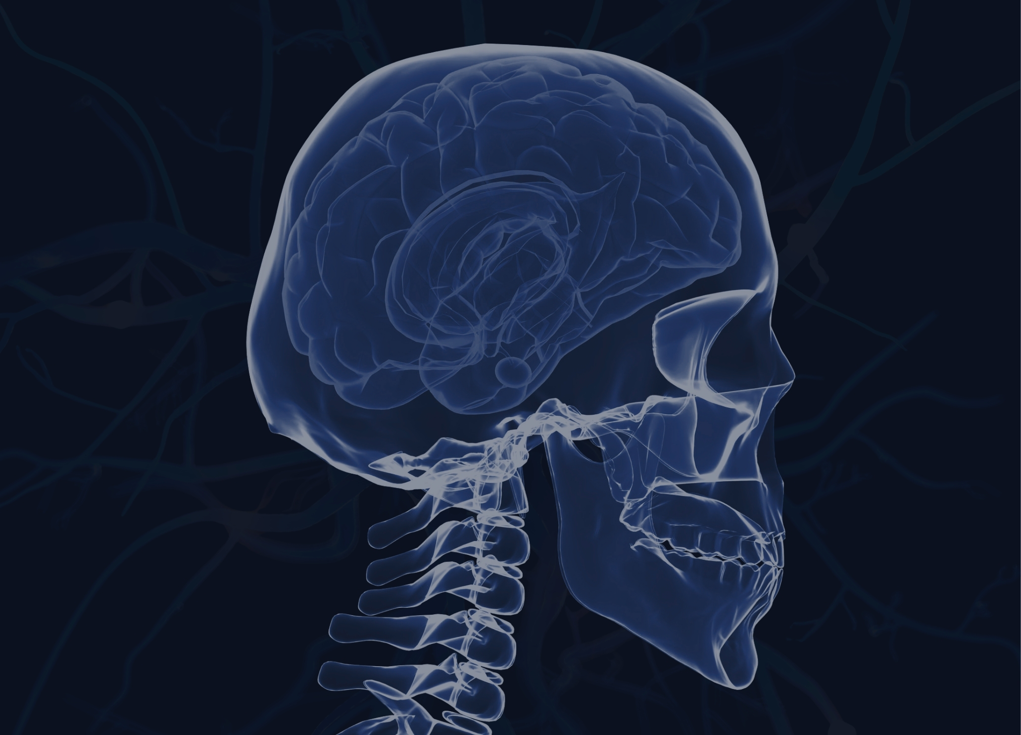 Nervous System Capacity