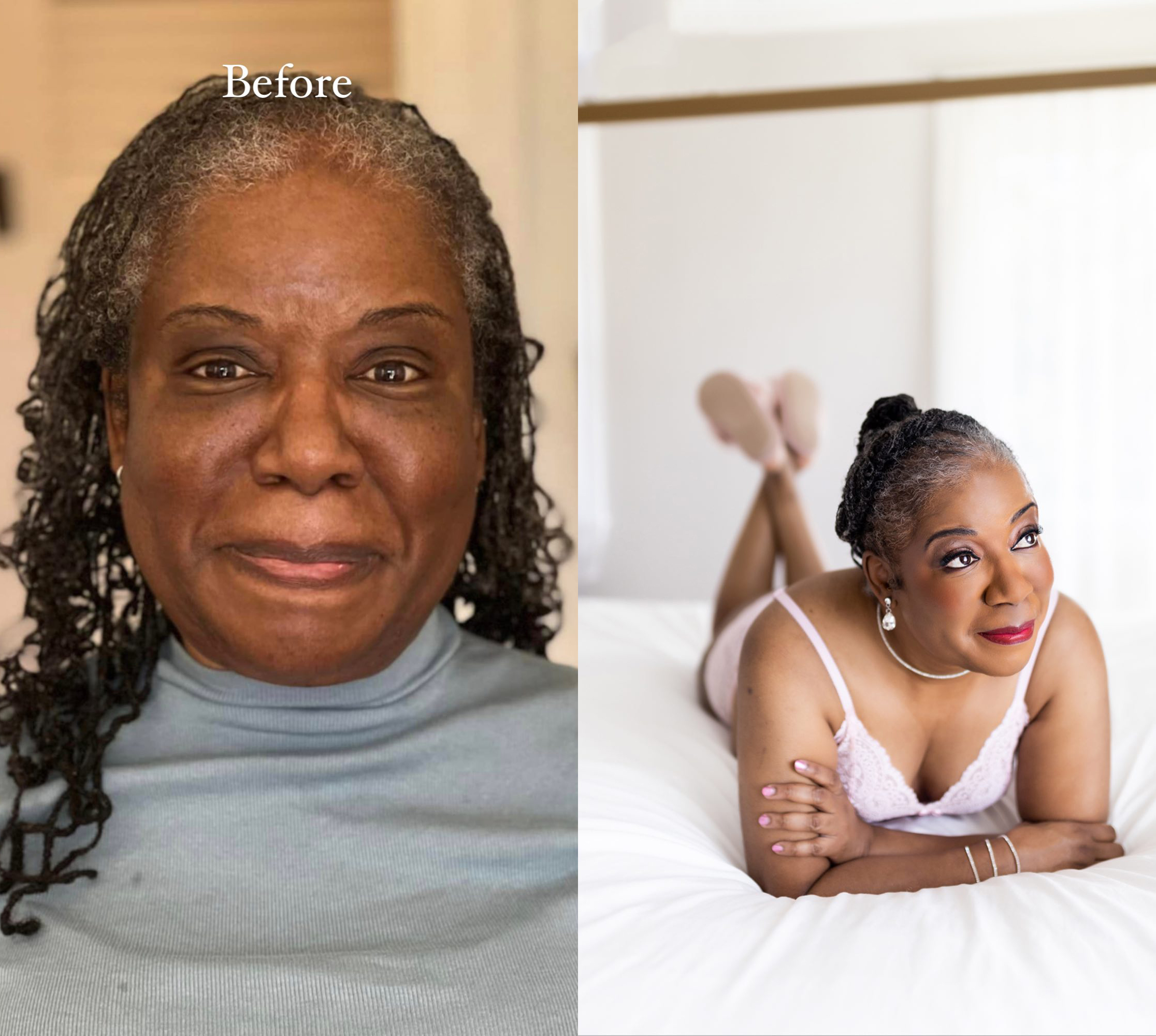 Before and after