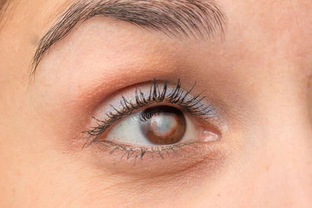 regular eye exams