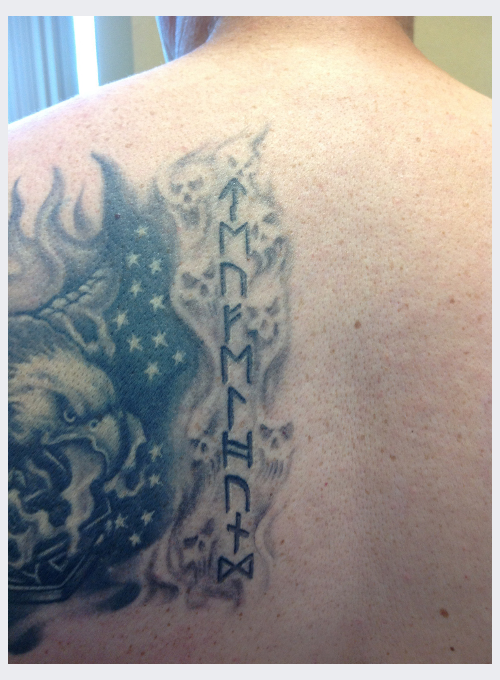 Back tattoo before and after PicoSure laser removal — before