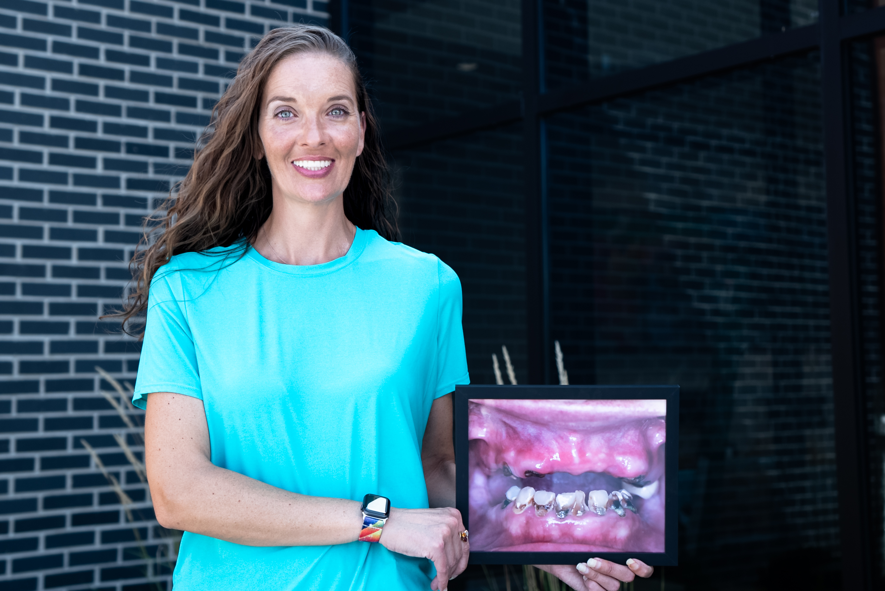 AOMS All-on-4 patient holding a before photo of failing teeth