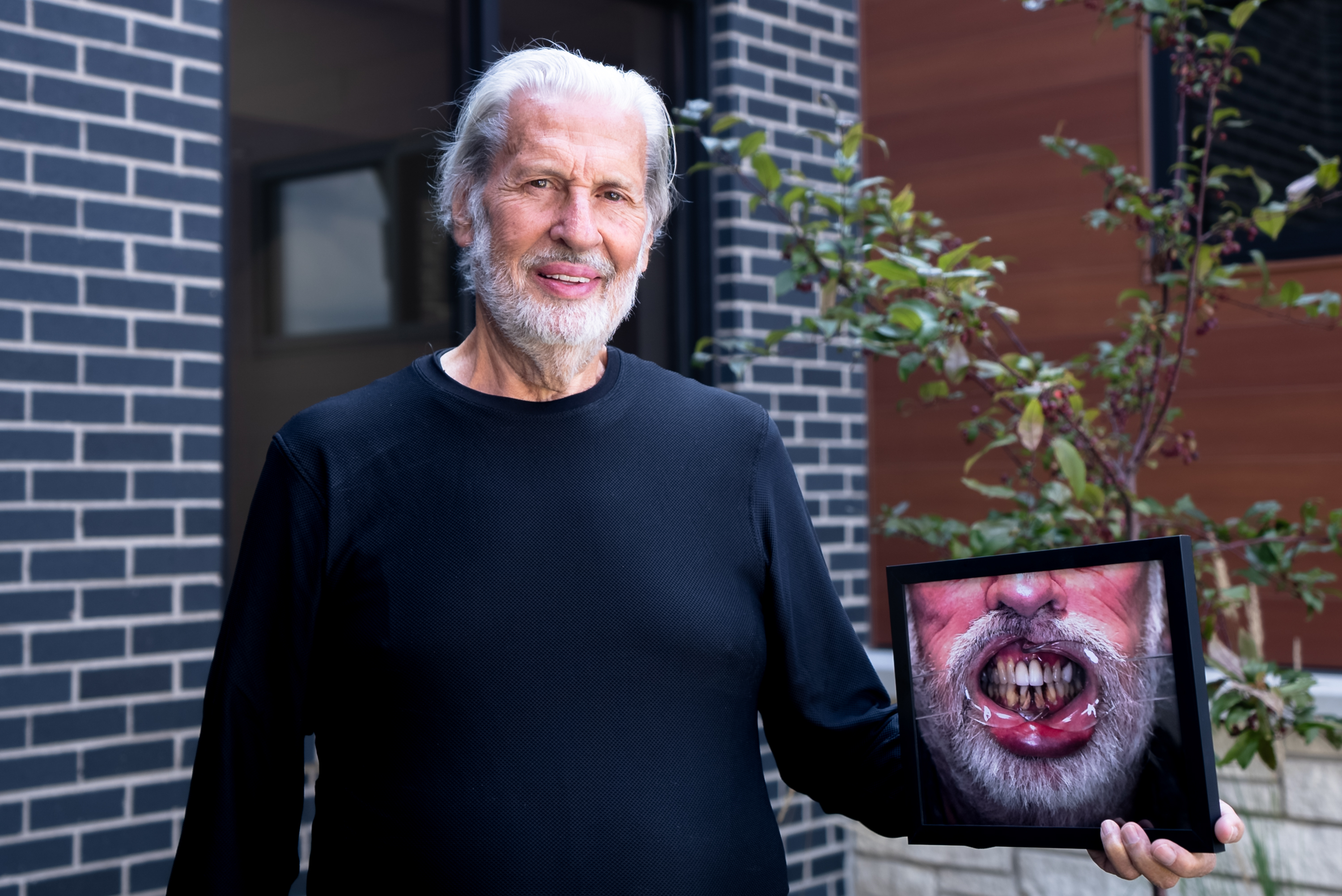 AOMS All-on-4 patient holding a photo of their teeth before treatment