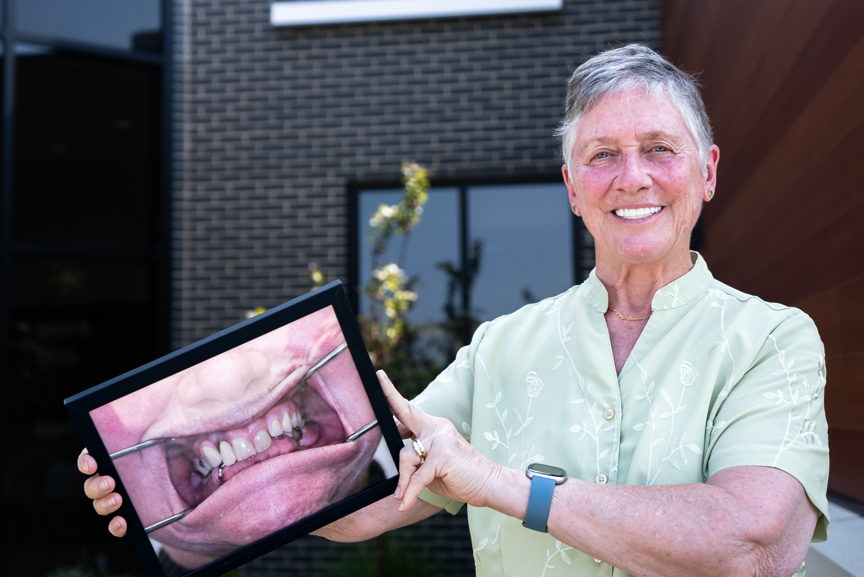 AOMS All-on-4 patient pointing at a photo of their old smile