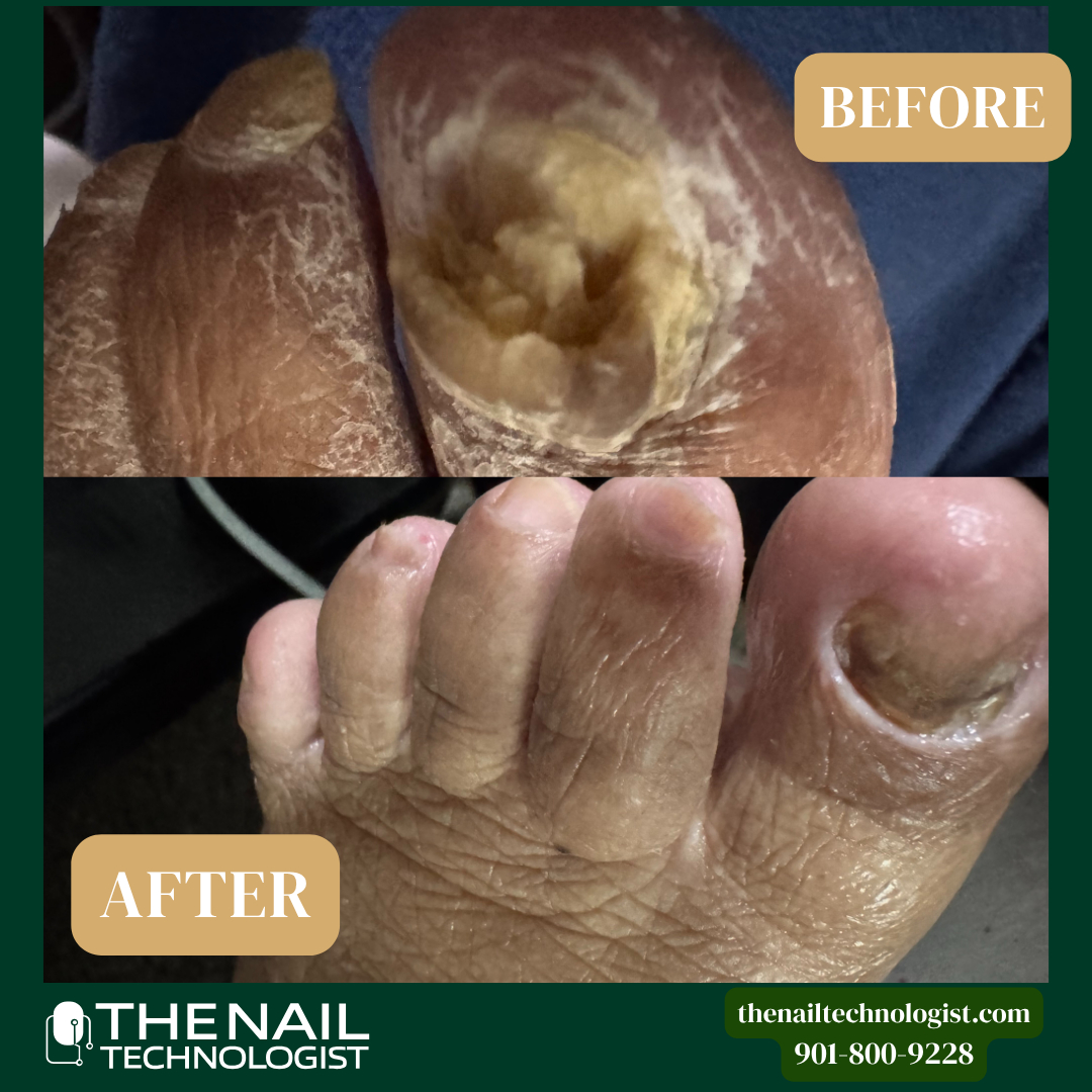 Before and after foot care