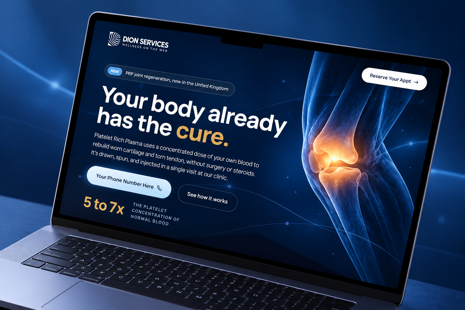 Platelet Rich Plasma service funnel screenshot