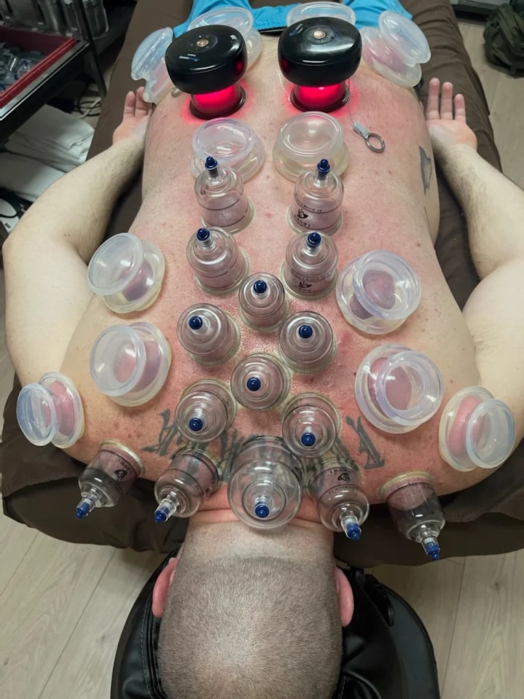 Myoskeletal Alignment