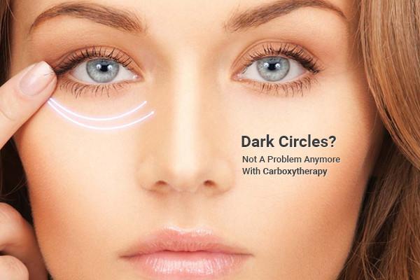 Ways to get rid of dark under-eye
