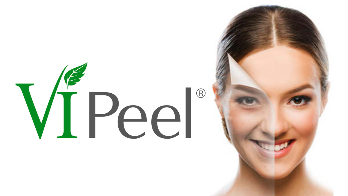 Chemical Peel  lake havasu