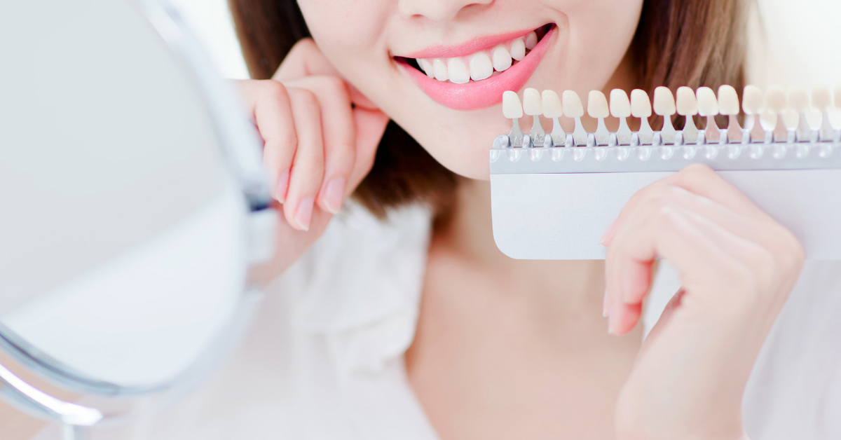 Teeth Whitening in Singapore: In-Clinic vs At-Home vs DIY (What Actually Works)