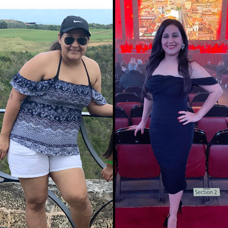 Transformación real Challenge Sin Celulitis