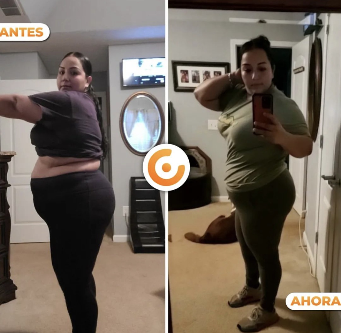 Transformación real Challenge Sin Celulitis